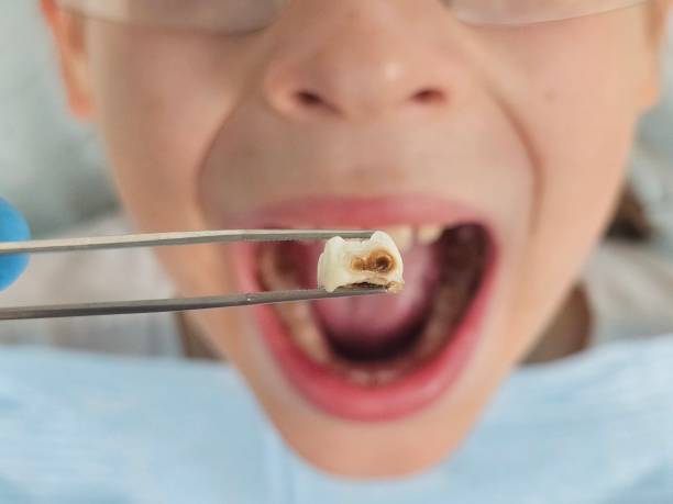 Best Emergency Dental Services for Seniors in Osceola, AR